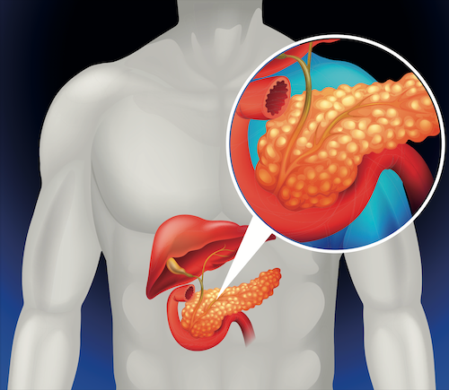 Pancreatic & Biliary Surgery